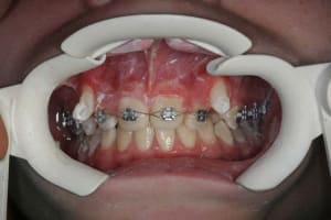 Img 1 qqvtsv - Eugenol