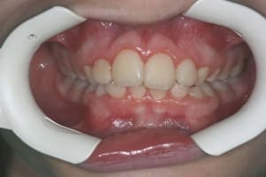 Img 1 qsklcy - Eugenol