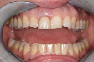 Img 2009 ivuiwj - Eugenol