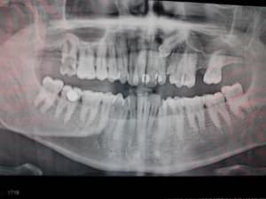 Img 20141227 175851 rkxg1p - Eugenol