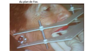 Img 20190317 204157 cxitdg - Eugenol