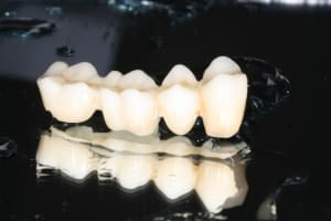 Img 2039 g5sfyz - Eugenol