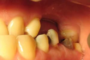 Img 2058   copie ptvwpy - Eugenol