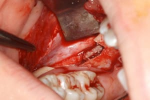 Img 2074 xuh9pm - Eugenol