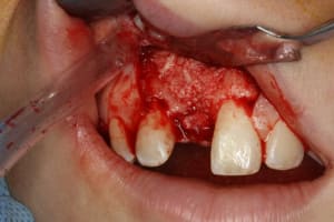 Img 2084 uhyw9w - Eugenol