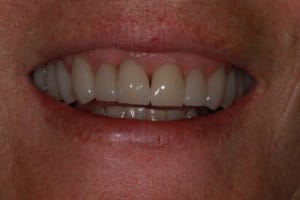 Img 2106 pnrela - Eugenol