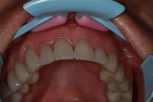 Img 2109 i1x6h8 - Eugenol