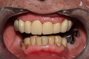 Img 2168 x8kjwe - Eugenol