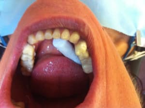 Img 2241 lnwflk - Eugenol