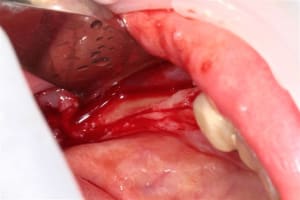 Img 2315 arnlgl - Eugenol