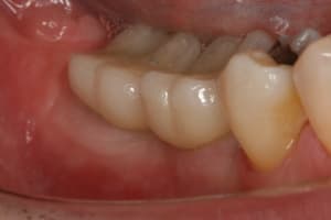 Img 2383 f3qbi1 - Eugenol