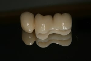 Img 2391 vbfac7 - Eugenol