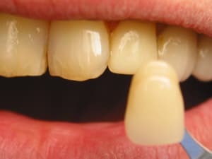 Img 2430 rnmfrc - Eugenol