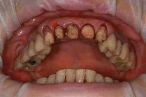 Img 2521 tbzyae - Eugenol