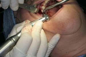 Img 2705 n6nln5 - Eugenol