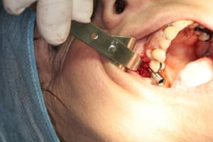 Img 2708 noa617 - Eugenol