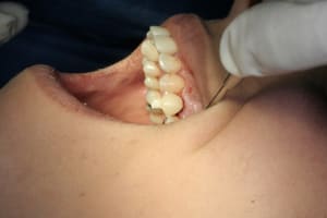 Img 2745 spi4yt - Eugenol
