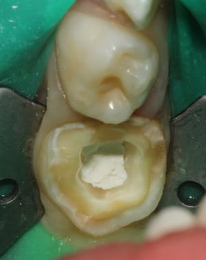 Img 2799 d3lwlz - Eugenol