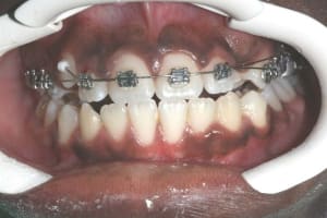 Img 2 f1urwp - Eugenol