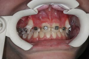 Img 2 pbiycv - Eugenol