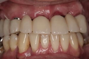 Img 3143 swt7yk - Eugenol