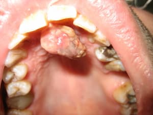 Img 3150 brt4vp - Eugenol
