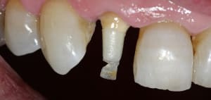 Img 3165 lr2wfs - Eugenol