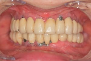 Img 3201 do6gy0 - Eugenol