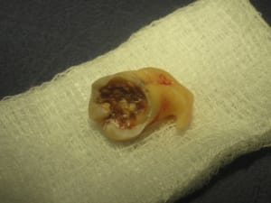Img 3305 misng5 - Eugenol