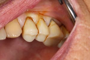 Img 3349 diqryh - Eugenol