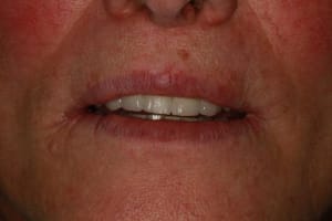 Img 3417 qlsgdo - Eugenol