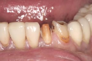 Img 3597 mrq6zv - Eugenol