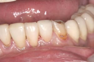 Img 3598 f7cy8p - Eugenol