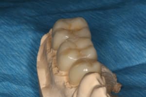 Img 3764  50   v0ivu4 - Eugenol