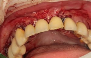 Img 3813 jxcle4 - Eugenol