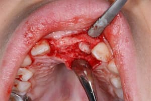 Img 3 by7ex5 - Eugenol