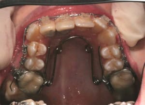 Img 3 peedb8 - Eugenol
