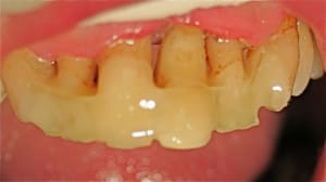 Img 4137 b49zy7 - Eugenol