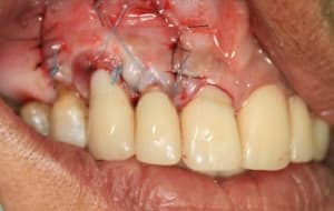 Img 4440 fi5ghi - Eugenol