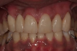 Img 4510 jdijjd - Eugenol