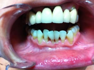 Img 4745 hx0lgn - Eugenol