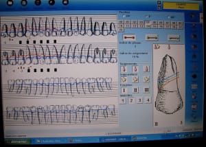 Img 4813 drpxfu - Eugenol