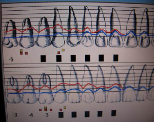 Img 4814 eha9ql - Eugenol