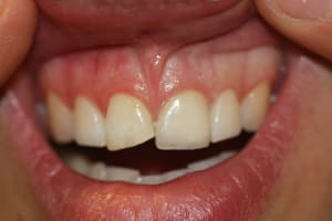 Img 4824 g4eixz - Eugenol