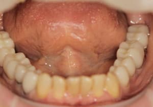 Img 4840 url34k - Eugenol