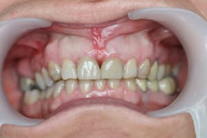 Img 4844 r2mjht - Eugenol