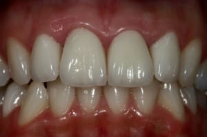 Img 4878 small kbucww - Eugenol