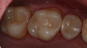 Img 4940 ead2wr - Eugenol