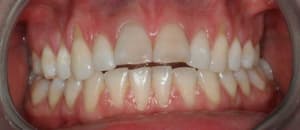 Img 5032 eimylb - Eugenol