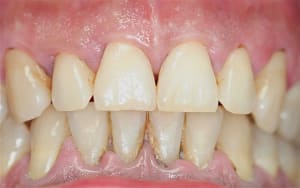 Img 5075 dqxuo3 - Eugenol